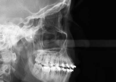 Radiografía Guadadental 1