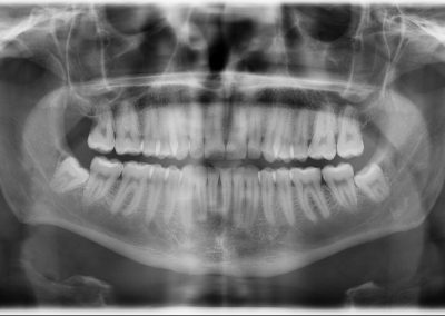 Radiografía Guadadental 2