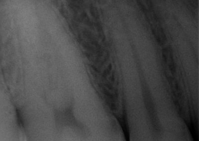 Radiolgrafía Guadadental 3